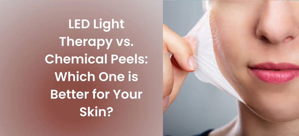Close-up of a person peeling a skincare mask off their face, alongside text reading "LED Light Therapy vs. Chemical Peels: Which One is Better for Your Skin?" comparing two popular skincare treatments.