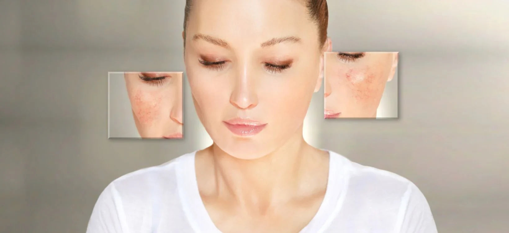 Close-up image of a woman with clear skin, showing before and after effects of yellow LED light therapy for reducing facial redness and rosacea symptoms.