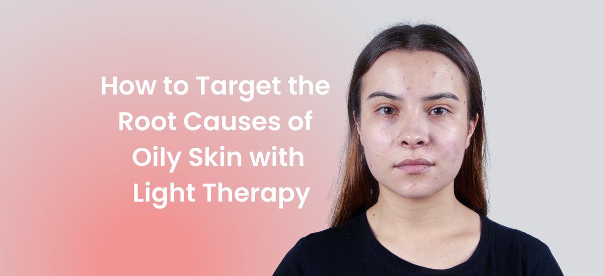 A woman with oily skin and acne, with text reading "How to Target the Root Causes of Oily Skin with Light Therapy.