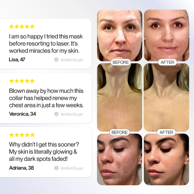 Glotech™ Mask Pro (B2B)