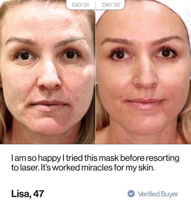 Customer before and after results