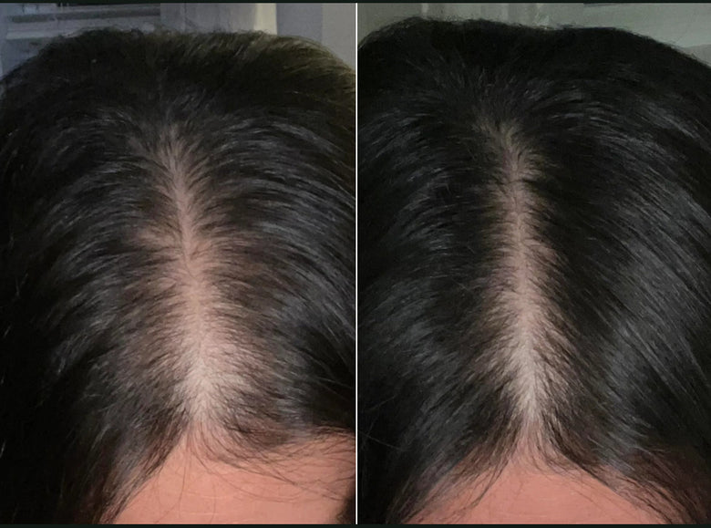 Kayla, 48 before and after using Best treatment