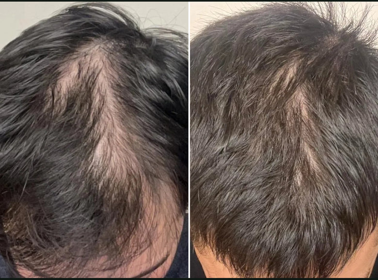 Jason, 39 before and after using Worked wonders
