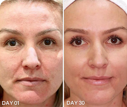 Reverse Signs of Aging