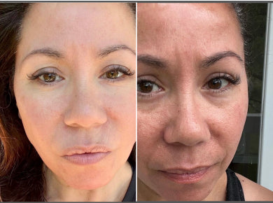 Ruby, 50 before and after using Glowing skin!