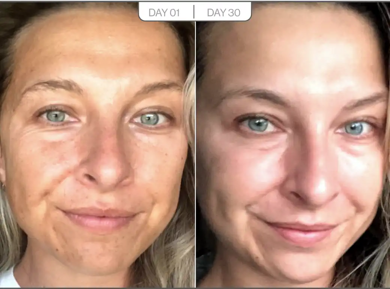 Karina, 39 before and after using Worth the money