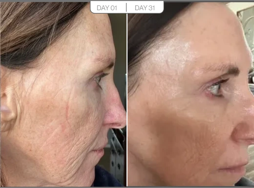 Tami J, 61 before and after using WOW!