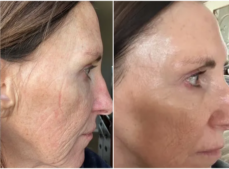 Tami J, 61 before and after using WOW!