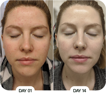 Customer before and after results