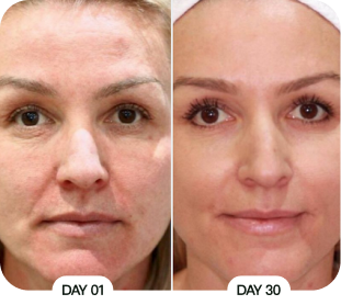 Customer before and after results