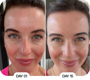 Customer before and after results