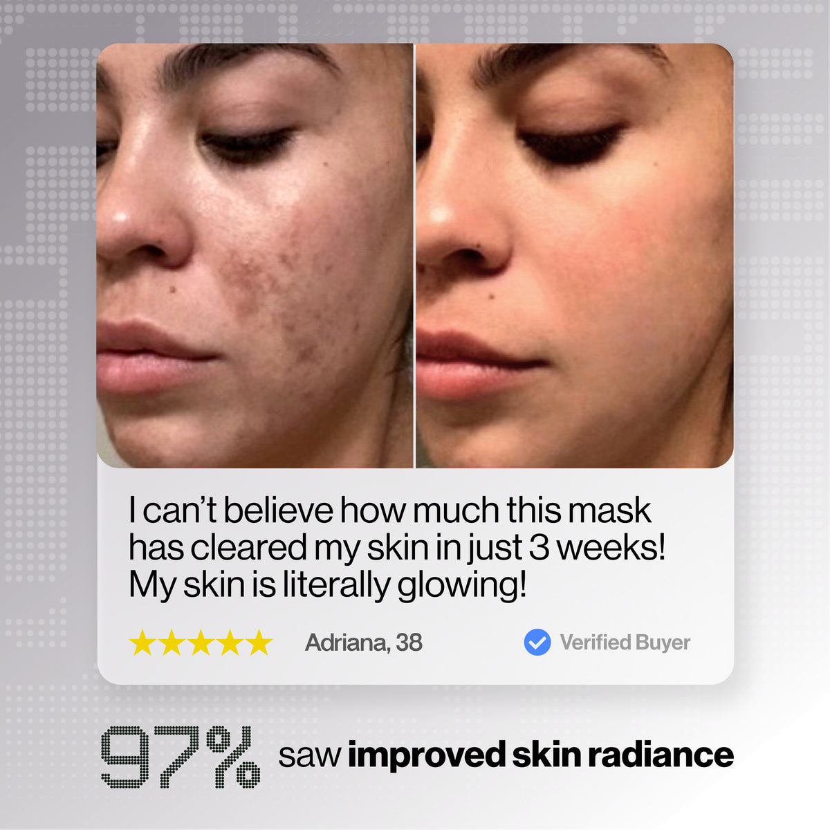 Glotech™ Mask Lite 2.0