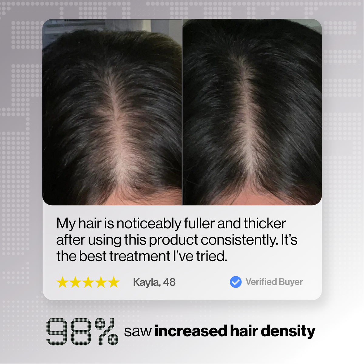 Glotech™ Hair Growth Bundle