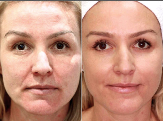 Lisa-before-after
